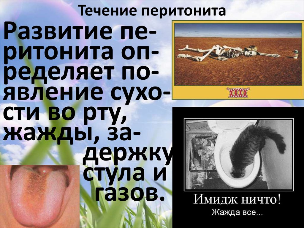 Течение перитонита