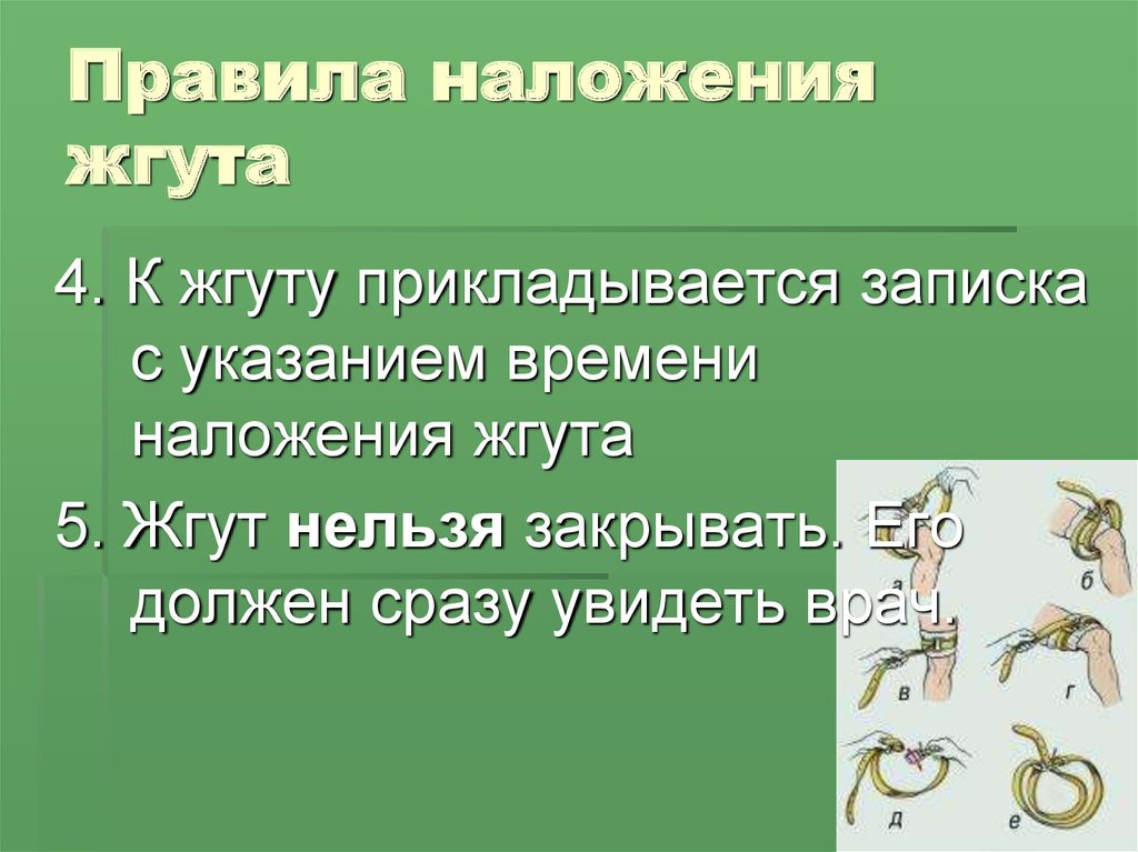 Максимальное время наложения жгута летом не более