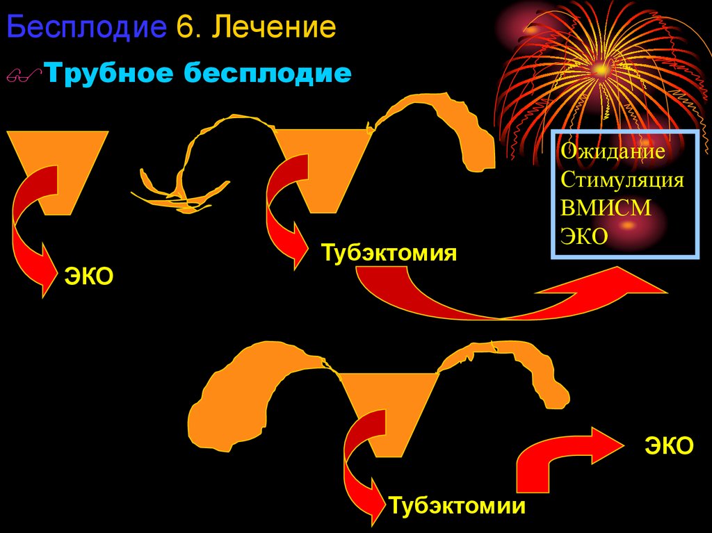 Трубное бесплодие картинки