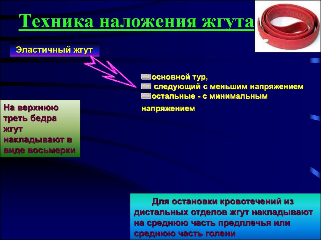 Признаки правильно наложенного жгута тест