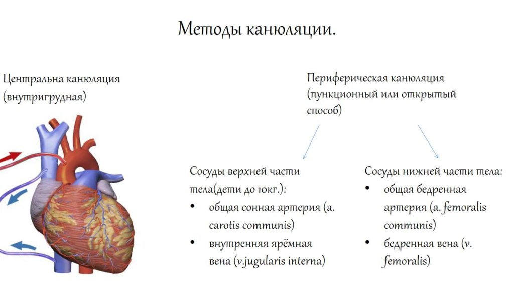 Методы канюляции.