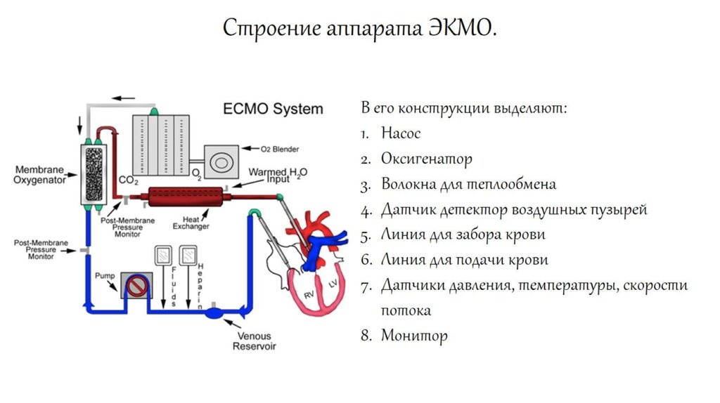 Строение аппарата ЭКМО.