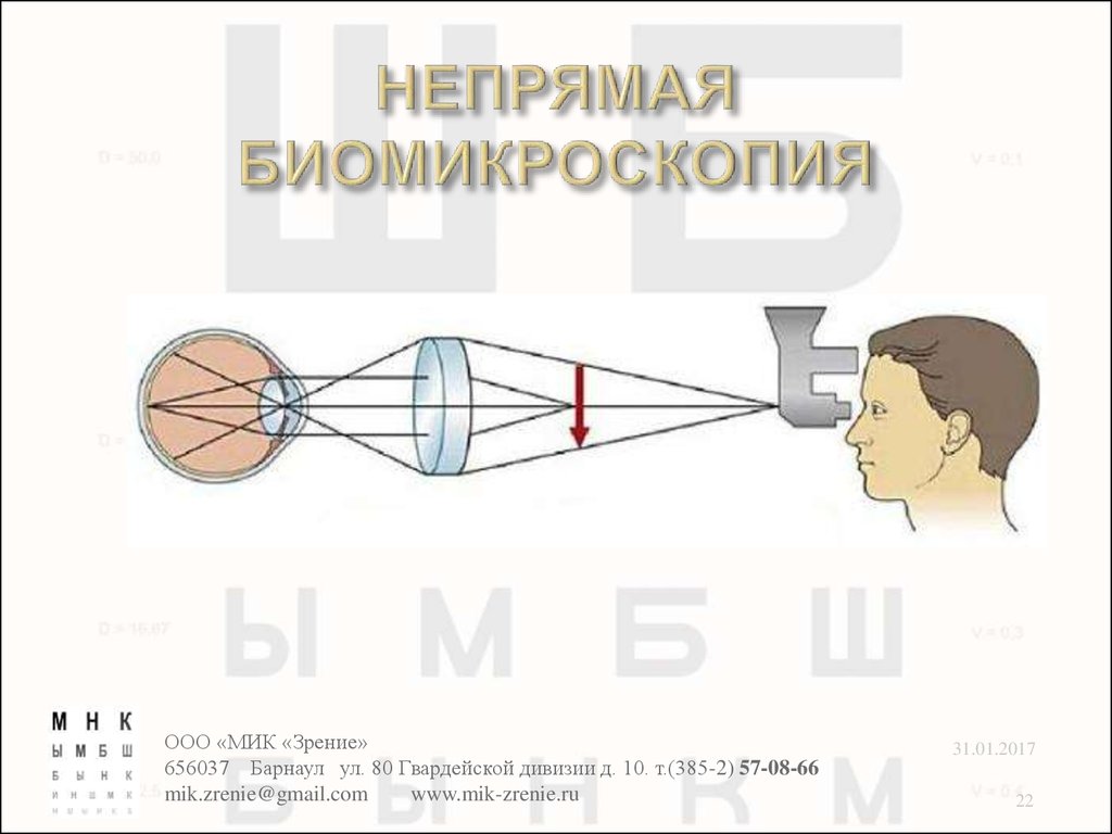 Линзы непрямой офтальмоскопии