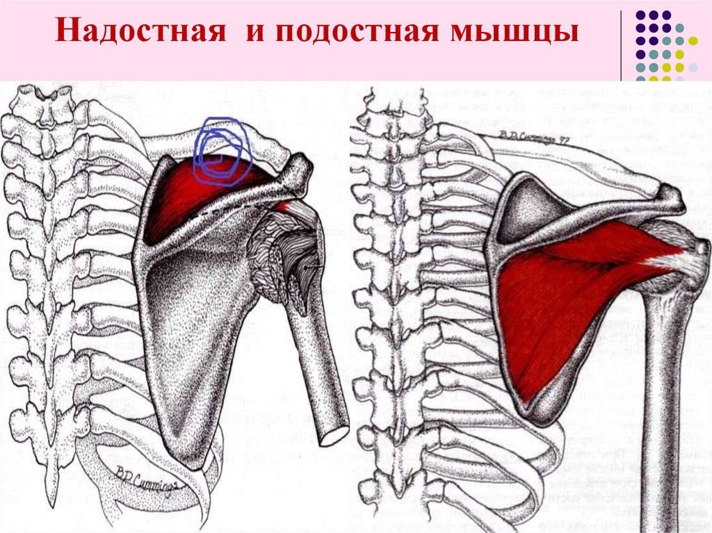 Надостная мышца. Надостная и подостная мышцы. Подостная и надостная мышца лопатки. Надостная мышца анатомия.