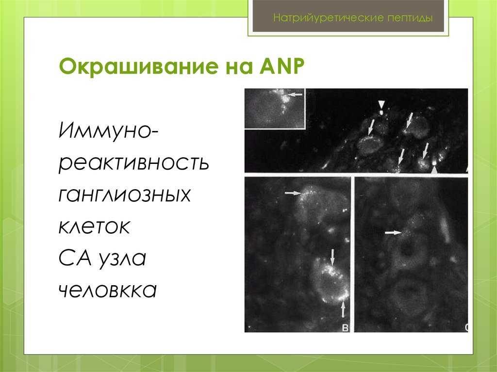 Натрийуретические пептиды