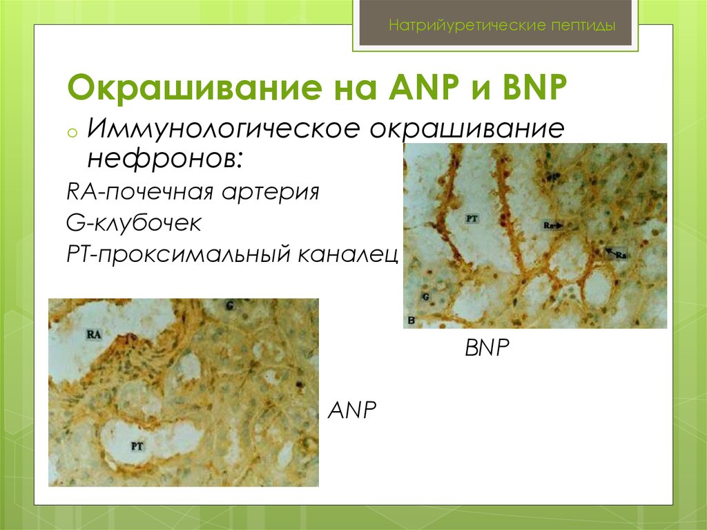 Мозговой пептид. Натрийуретический пептид. ANP пептид. Натрийуретический пептид в нефроне. Метод окрашивания ЦИТОГЕН.