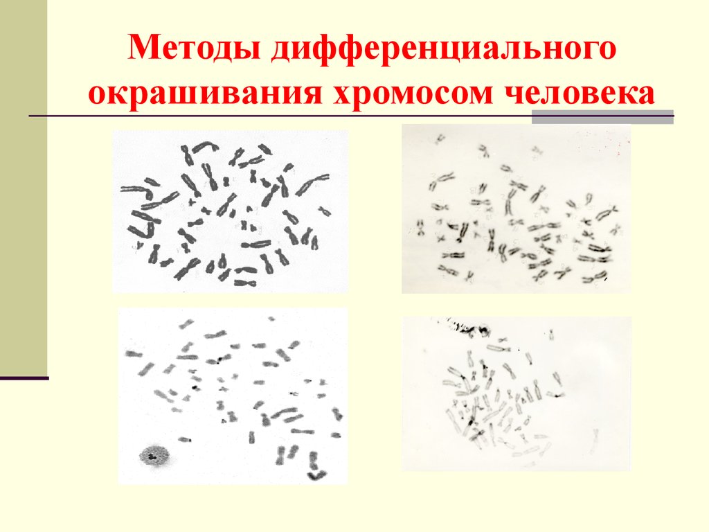 Изменение окраски хромосом. Метод дифференциальной окраски хромосом. Кариотип методом дифференциальной окраски хромосом. Дифференциальная окраска хромосом. Метод дифференциальной окраски.