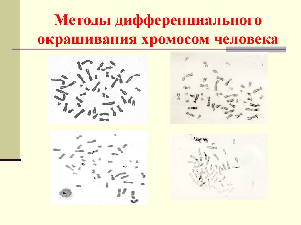 Окраска хромосом. Дифференциальная окраска хромосом. Дифференциальная GTG-окраска хромосом человека. Дифференциальный метод окраски. R окрашивание хромосом.