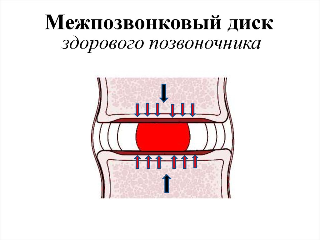 Межпозвонковый диск здорового позвоночника
