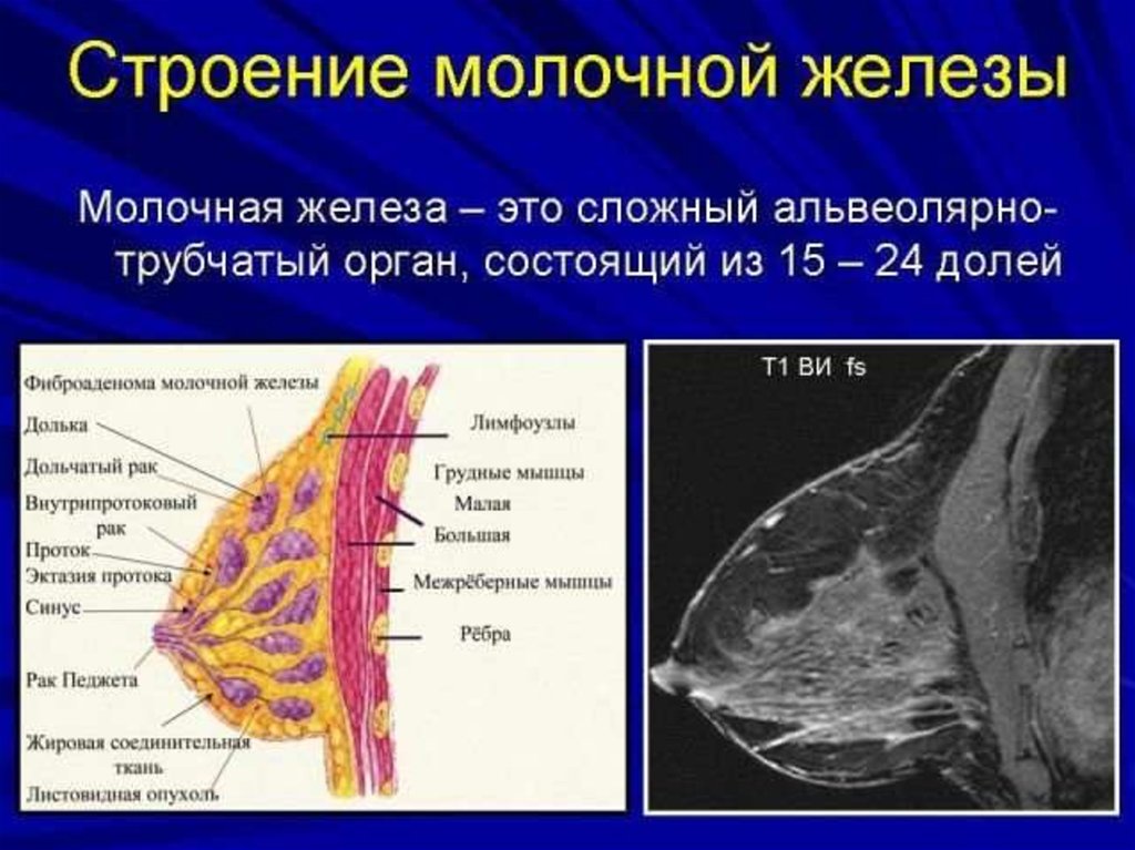 Анатомия молочной железы презентация