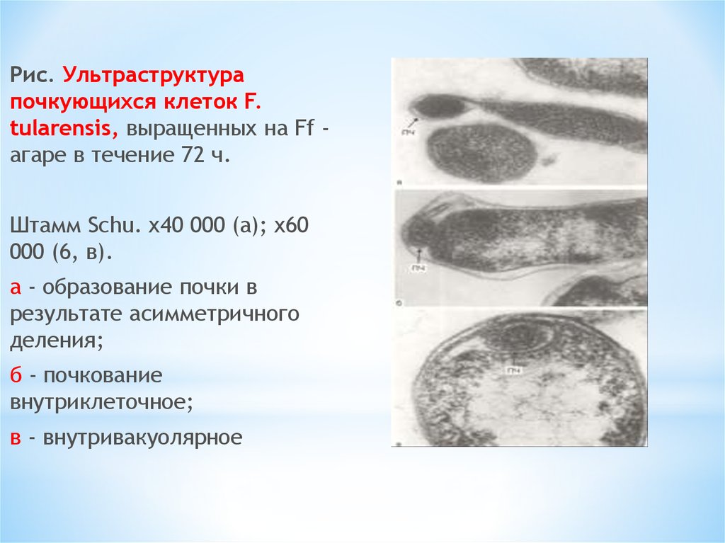 Возбудители чумы туляремии