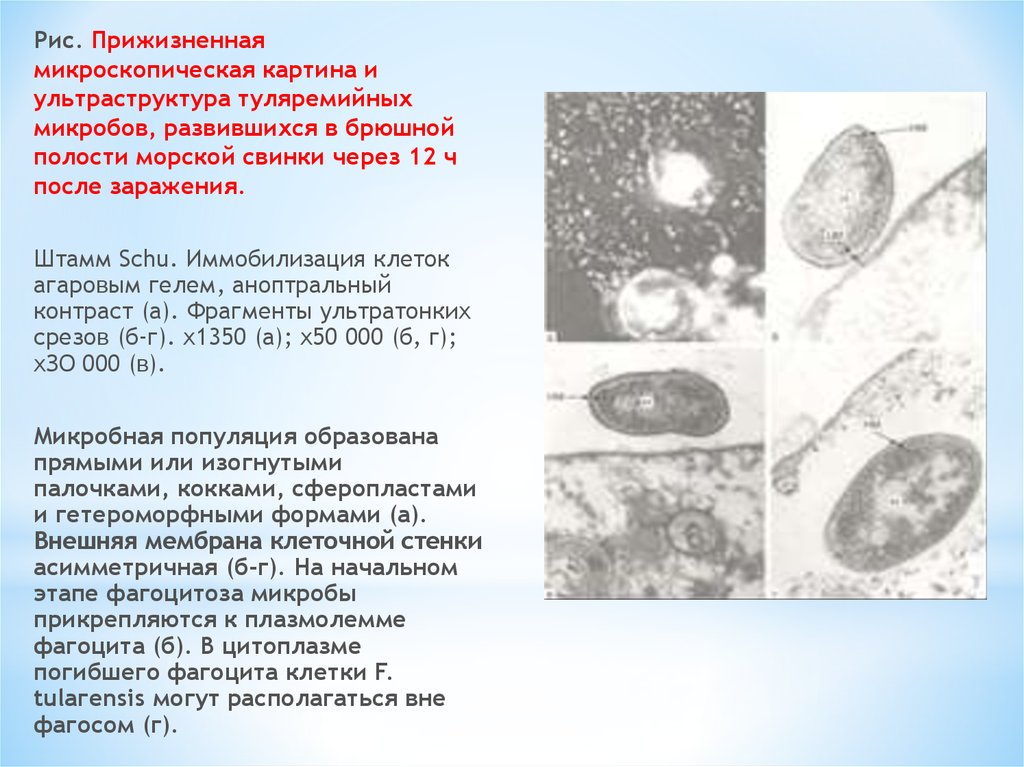 Туляремия возбудитель заболевания