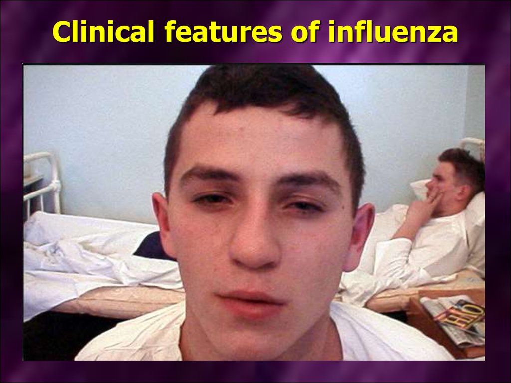 Clinical features of influenza