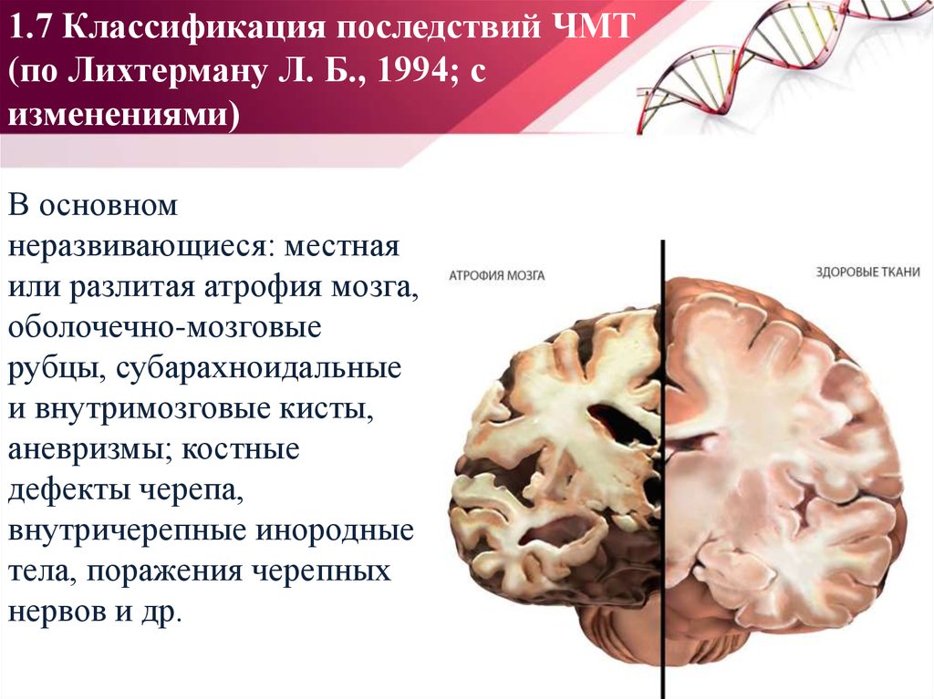 Атрофия головного мозга степени. ЧМТ сотрясение головного мозга. Последствия ЧМТ классификация. Классификация черепной травмы. Классификация внутричерепных травм.