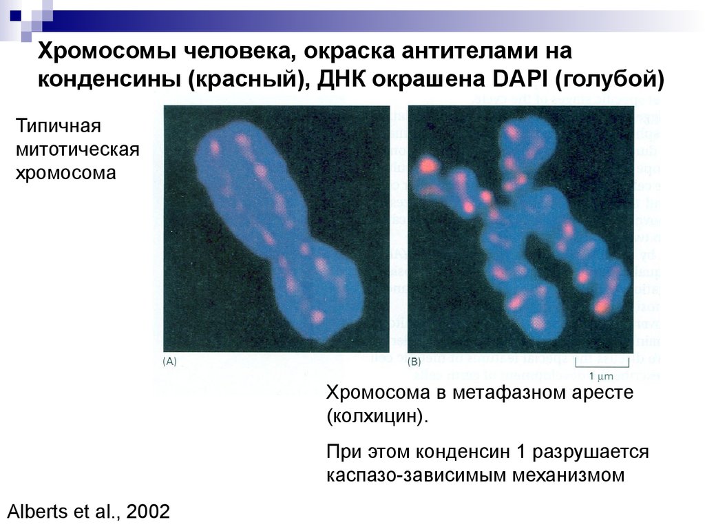 Изменение окраски хромосом. Хромосомы человека. Деление хромосом человека. Митотическая хромосома.
