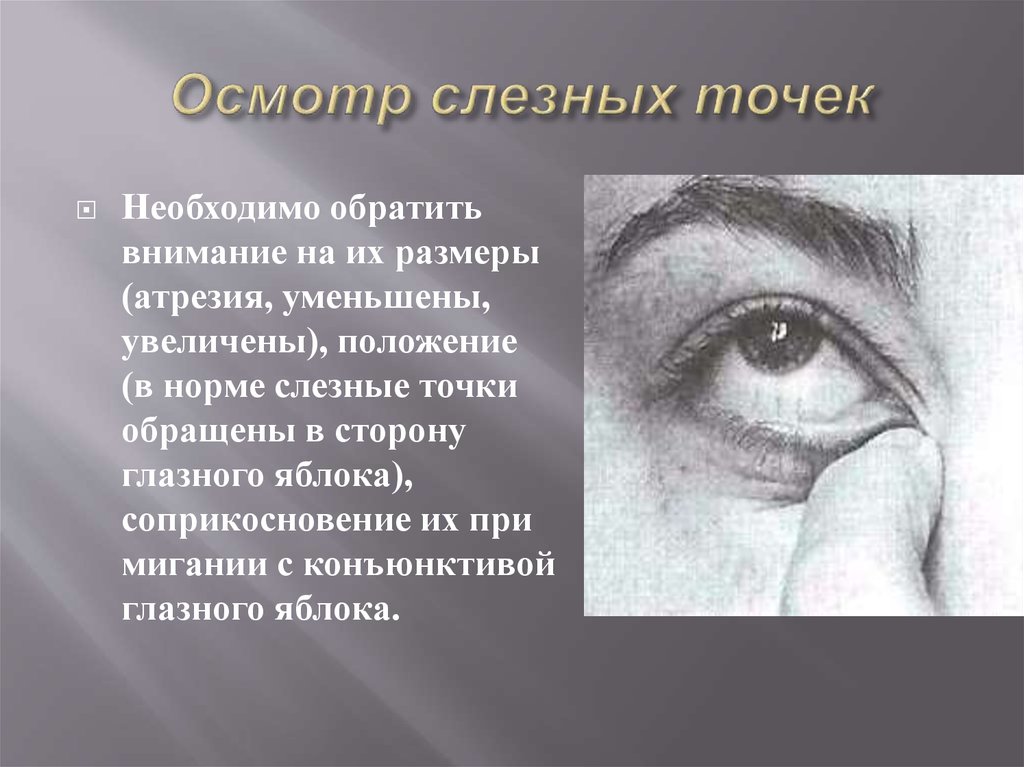 Осмотр век. Воспаление слезной точки. Увеличение нижней слезной точки.