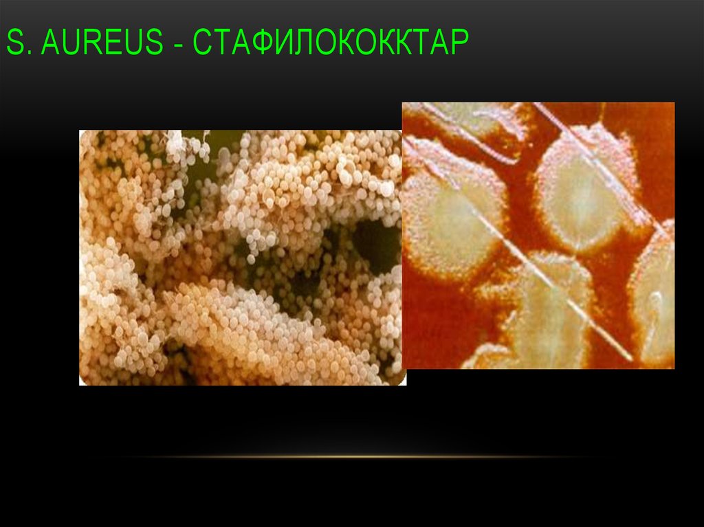 S. aureus - стафилококктар