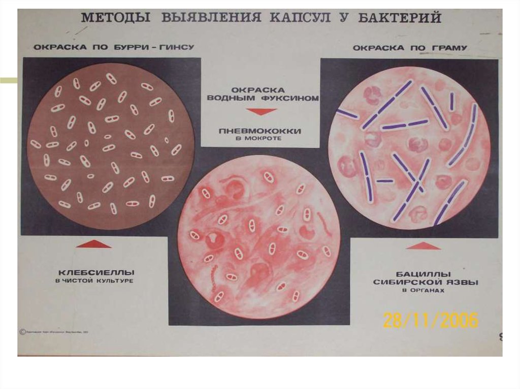 Окраска спор бактерий. Капсула бактерий окраска по Бурри-ГИНСУ. Klebsiella pneumoniae Бурри Гинса. Окраска капсульных бактерий по методу Бурри-Гинса. Klebsiella pneumoniae окраска по Бурри.