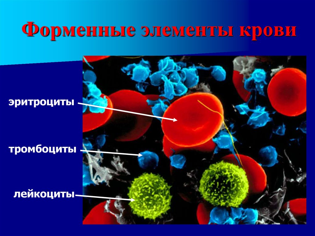 Клеток эритроциты лейкоциты эритроциты. Клетки крови эритроциты лейкоциты тромбоциты. Состав крови эритроциты лейкоциты тромбоциты. Эритроциты лейкоциты тромбоциты рисунок. Форменные элементы крови лейкоциты.