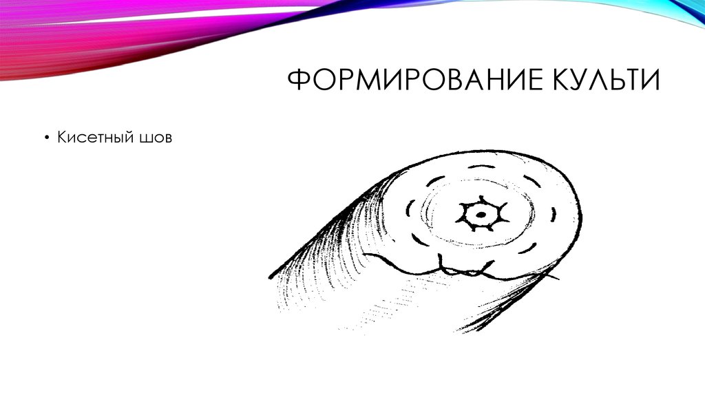 Формирование культи