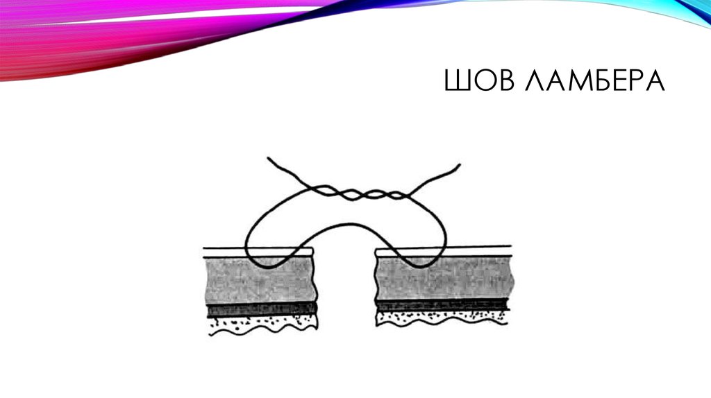 Жидкость шов. Шов Шмидена Ламбера в ветеринарии. Двухрядный шов Альберта-Ламбера. Кишечные швы Ламбера и Шмидена.