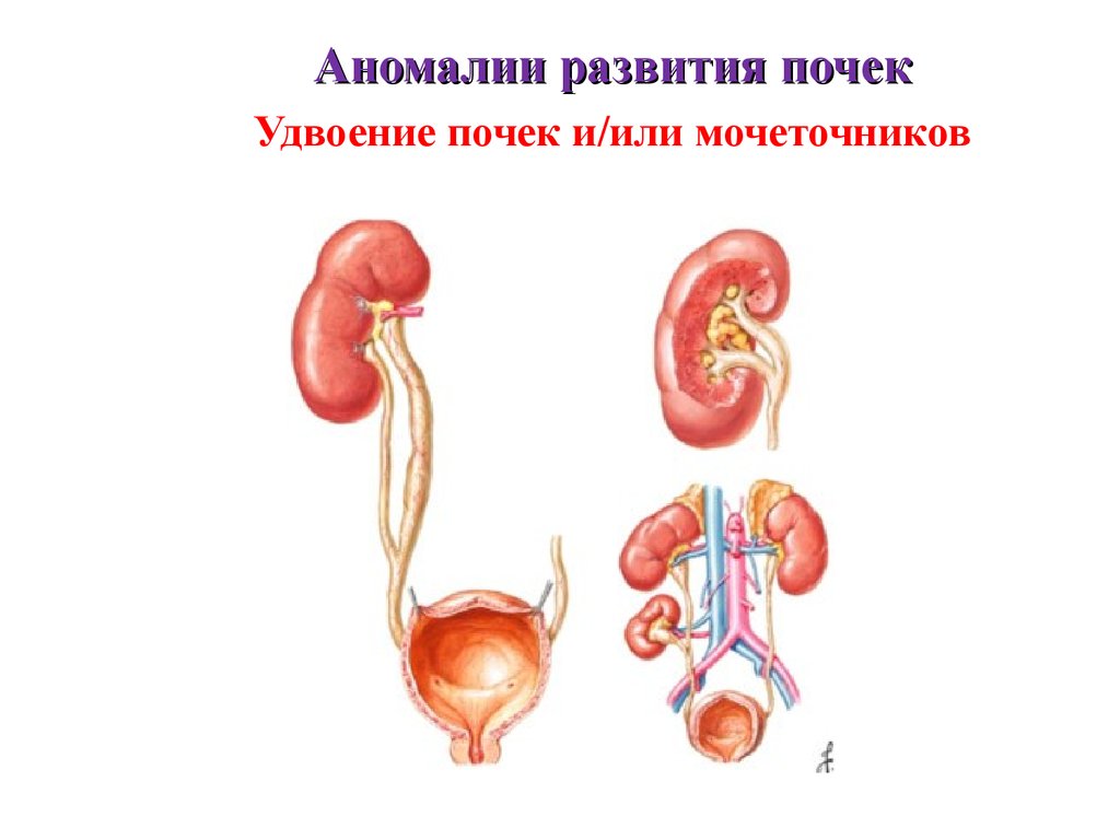 Развитие мочеточников