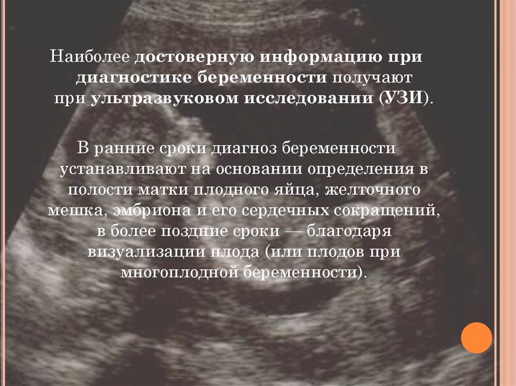 Можно ли делать часто узи при беременности. УЗИ беременности на ранних сроках. УЗИ по беременности на ранних сроках. Патология беременности ранних сроков УЗИ. Диагностирование беременности на ранних сроках УЗИ.