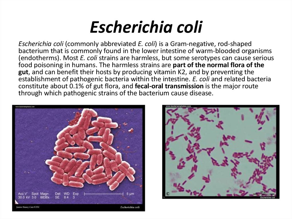 Coli sotwe. Escherichia coli гемолитические антибиотики. Бактерии эшерихия коли. Непатогенные эшерихии. Escherichia coli внешний вид.