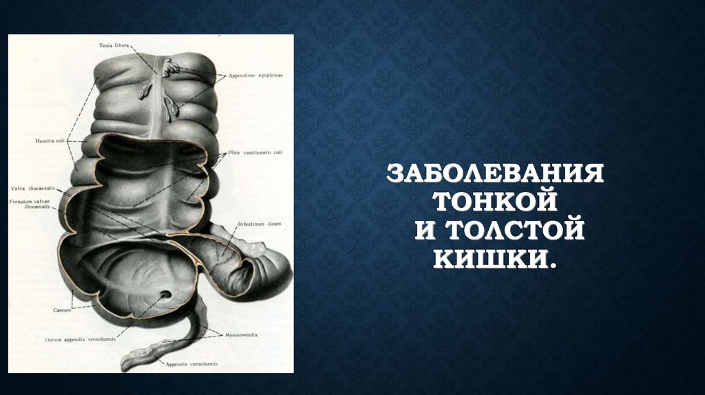 Болезни толстого. Болезни тонкой и толстой кишки. Заболевания тонкой кишки. Ишемия тонкой и толстой кишки. Острая ишемия тонкой кишки.