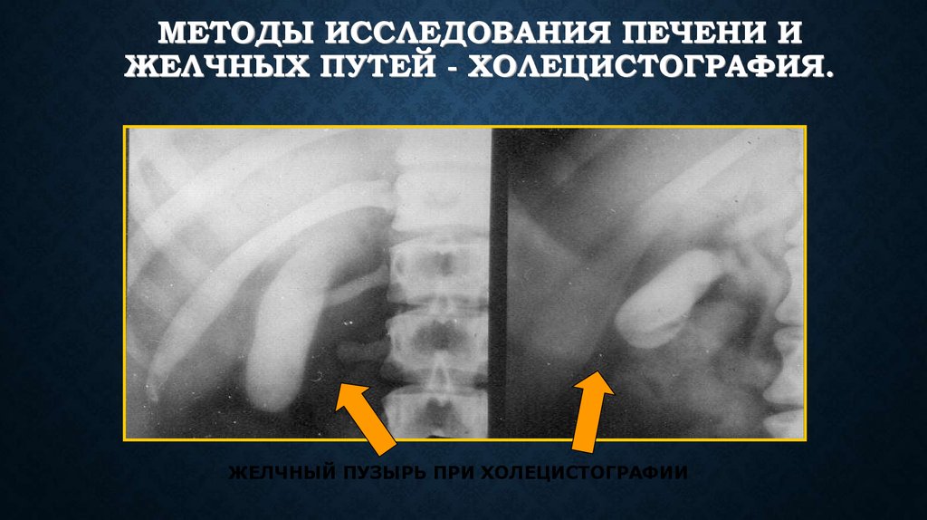 Лучевая диагностика желчевыводящих путей презентация