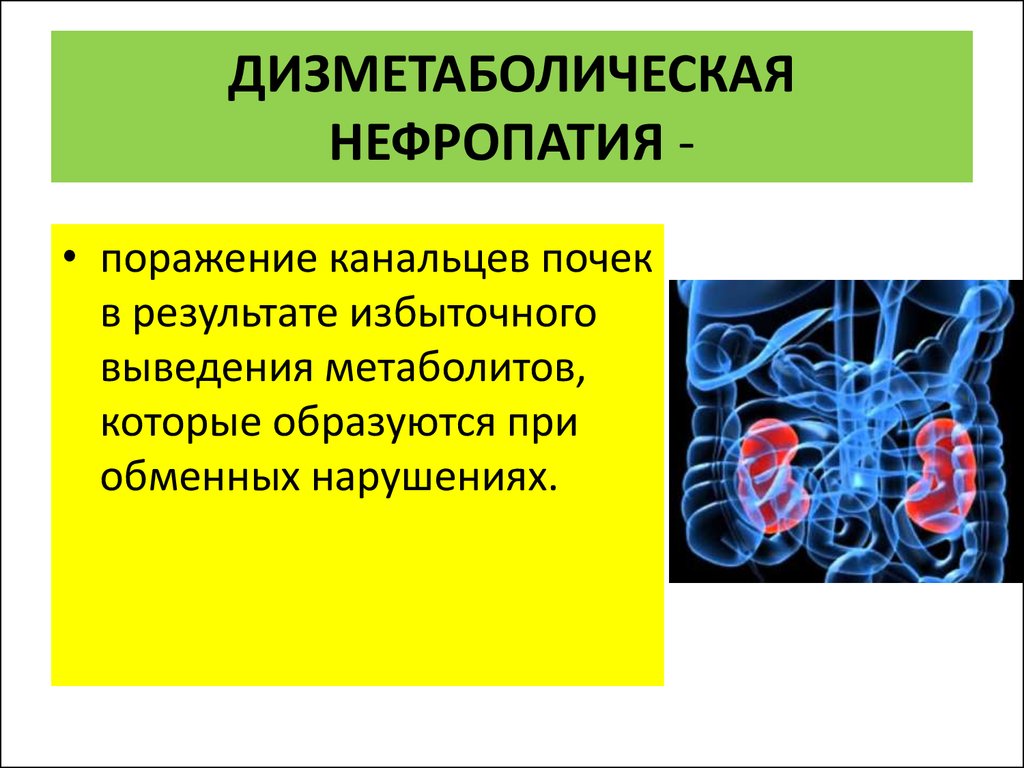 Дисметаболическая нефропатия что это. Дизметаболическая нефропатия. Дисметаболические нефропатии у детей клинические рекомендации. Нефропатия почек у детей. Дизметаболические нефропатии оксалурии у детей.