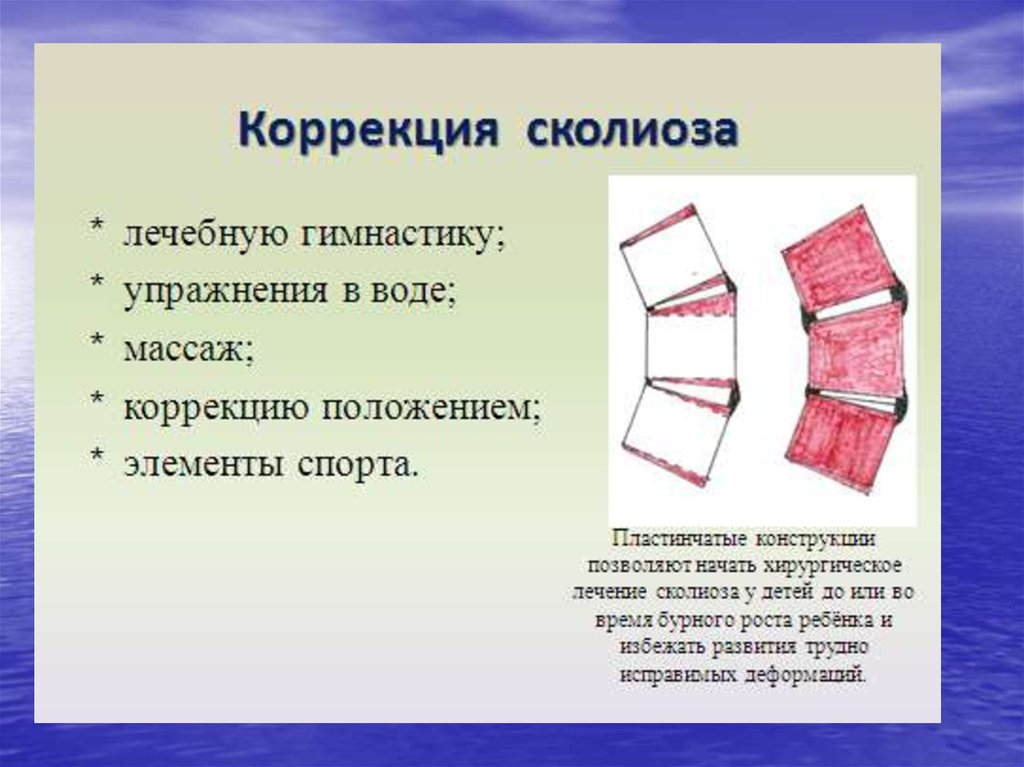 Коррекция положения. Коррекция положением. Коррекция позиций.