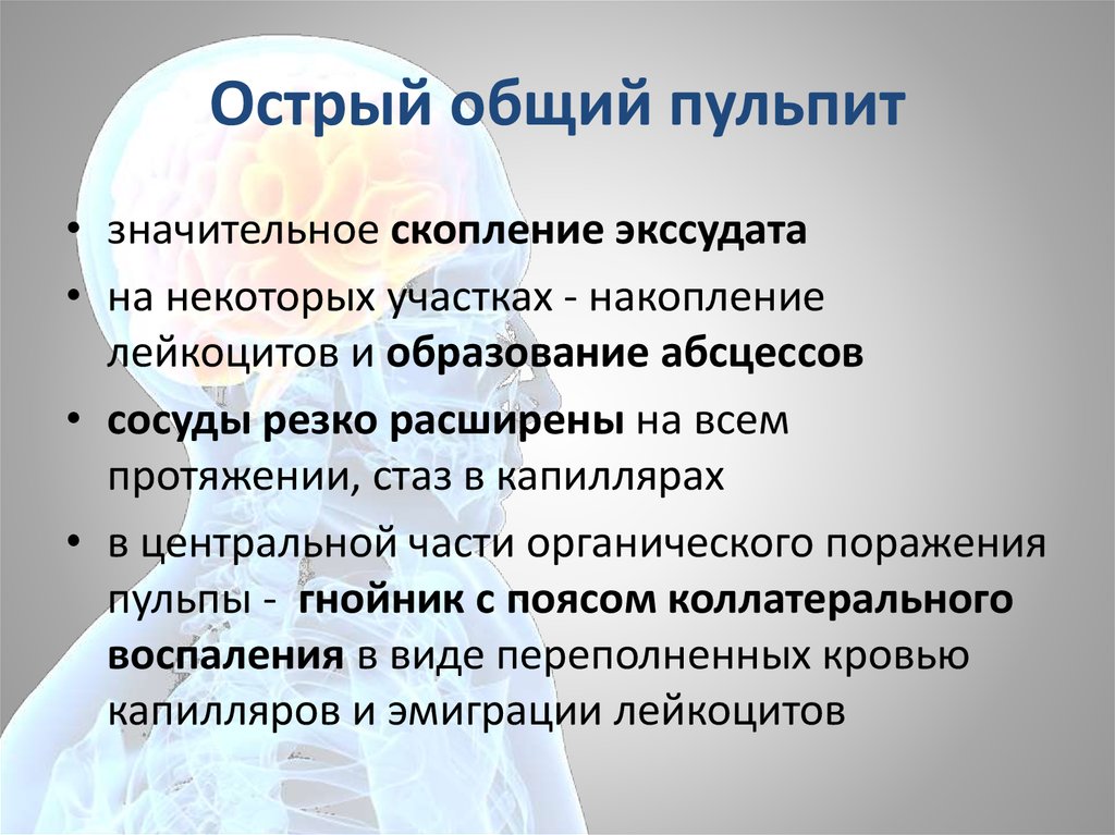 Острые формы пульпита