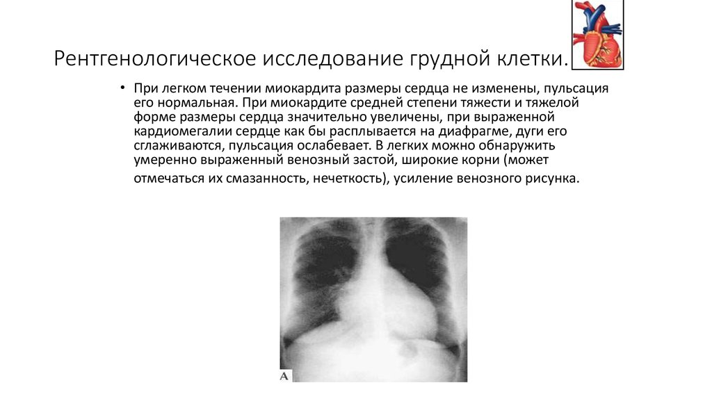 Исследование грудной клетки. Рентгенологическое исследование органов грудной клетки норма. Протокол описания рентгенограмм органов грудной клетки у детей. Протокол исследования органов грудной клетки. Таблица рентгенологическое исследование органов грудной клетки.