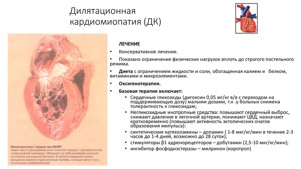 Рестриктивная кардиомиопатия презентация