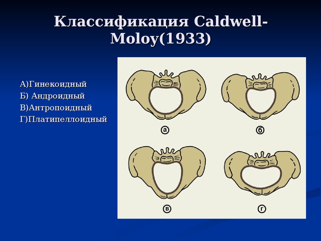 Анатомически узкий таз презентация