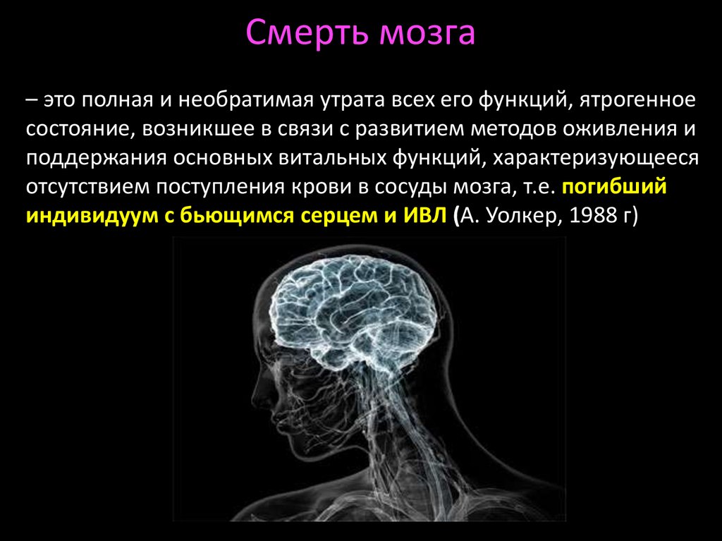 Мозг остановился. Смерть мозга. Мозг человека после смерти.