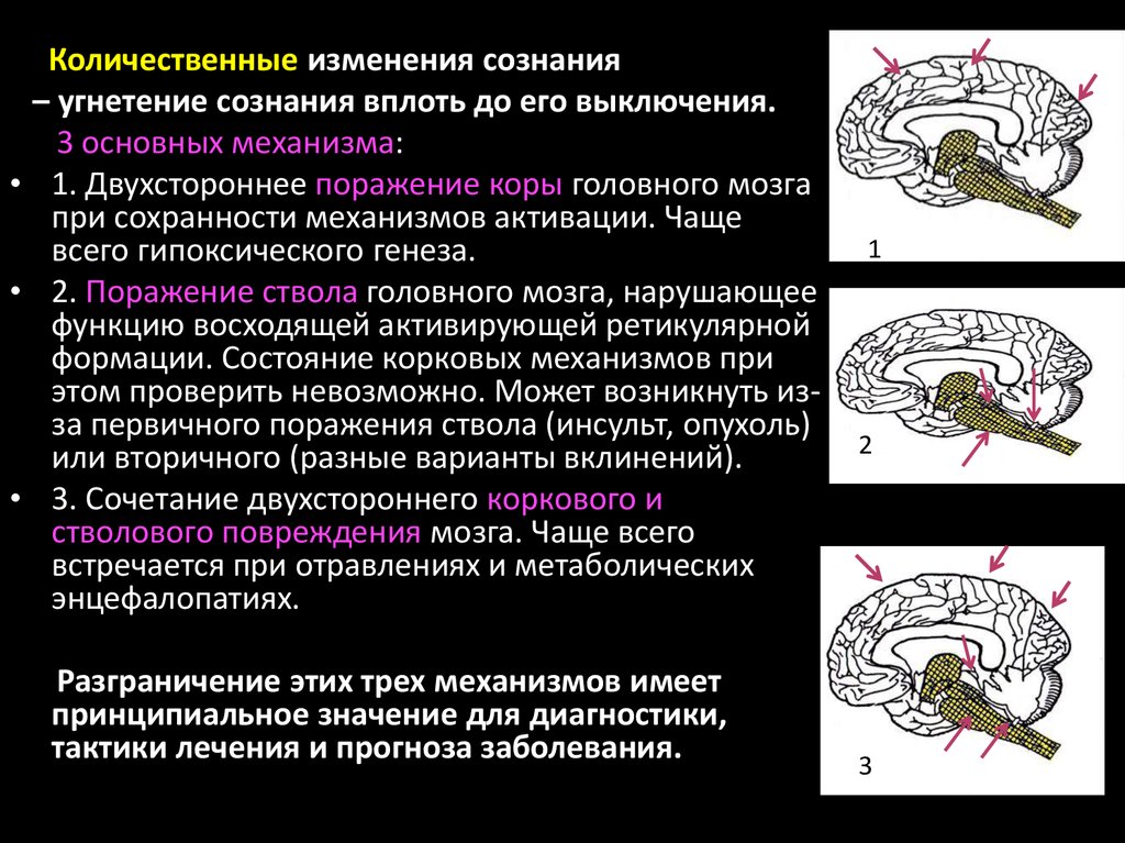 Энцефалопатия головного мозга последствия. Метаболическая энцефалопатия. Гипертоническая ангиоэнцефалопати. Поражение мозга при энцефалопатия. Метаболические изменения головного мозга.