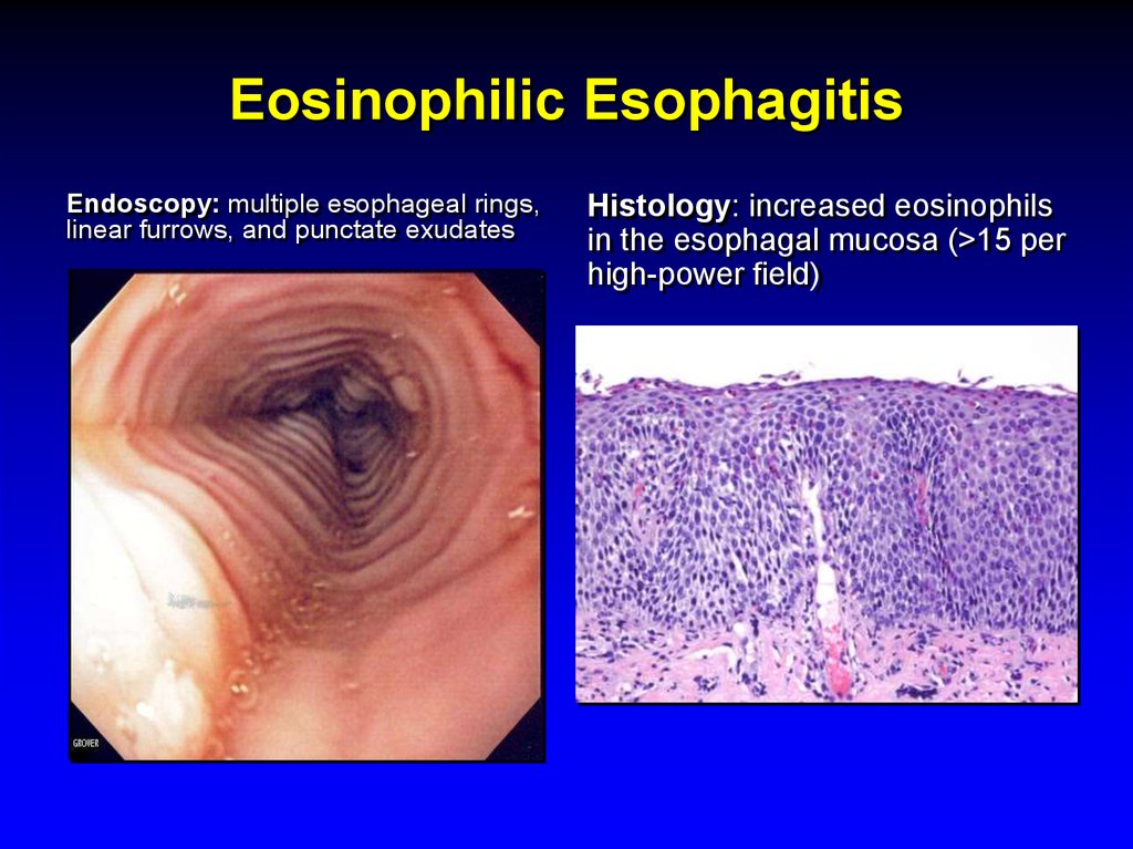 Esophagus Function