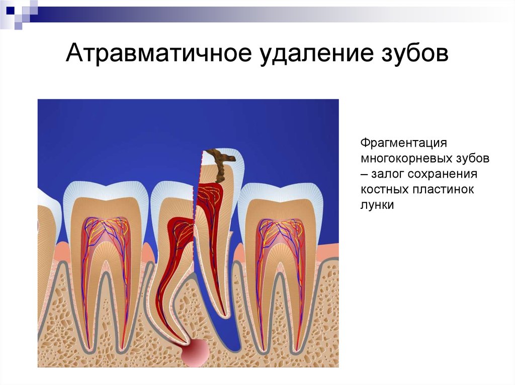Сколько стоят зубы человека