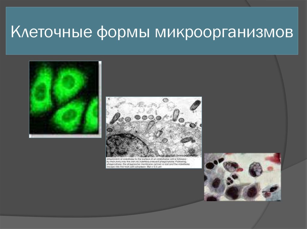 К клеточным формам относятся. Клеточные формы микроорганизмов. Клеточные формы микроорганиз. К клеточным формам микроорганизмов относятся. К клеточным формам микробов относят.