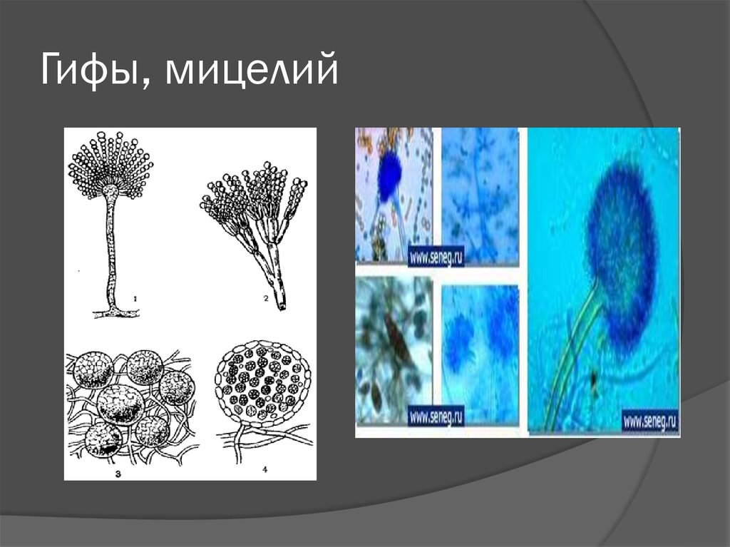 Гриб состоит из тонких нитей. Гифы мицелия. Строение мицелия. Грибы гифы мицелий. Гифы грибница мицелий.