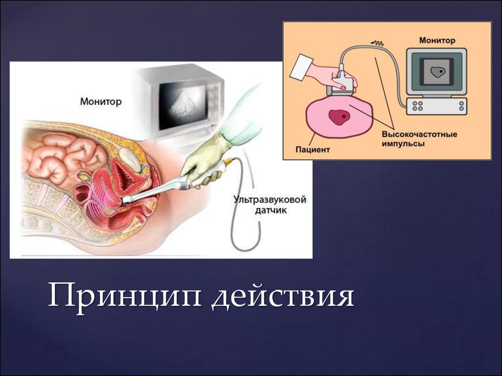 Для получения изображений в ультразвуковых сканерах используются