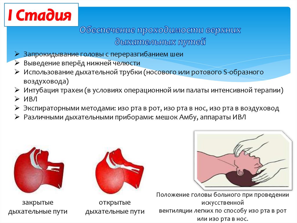 Стадия обеспечения