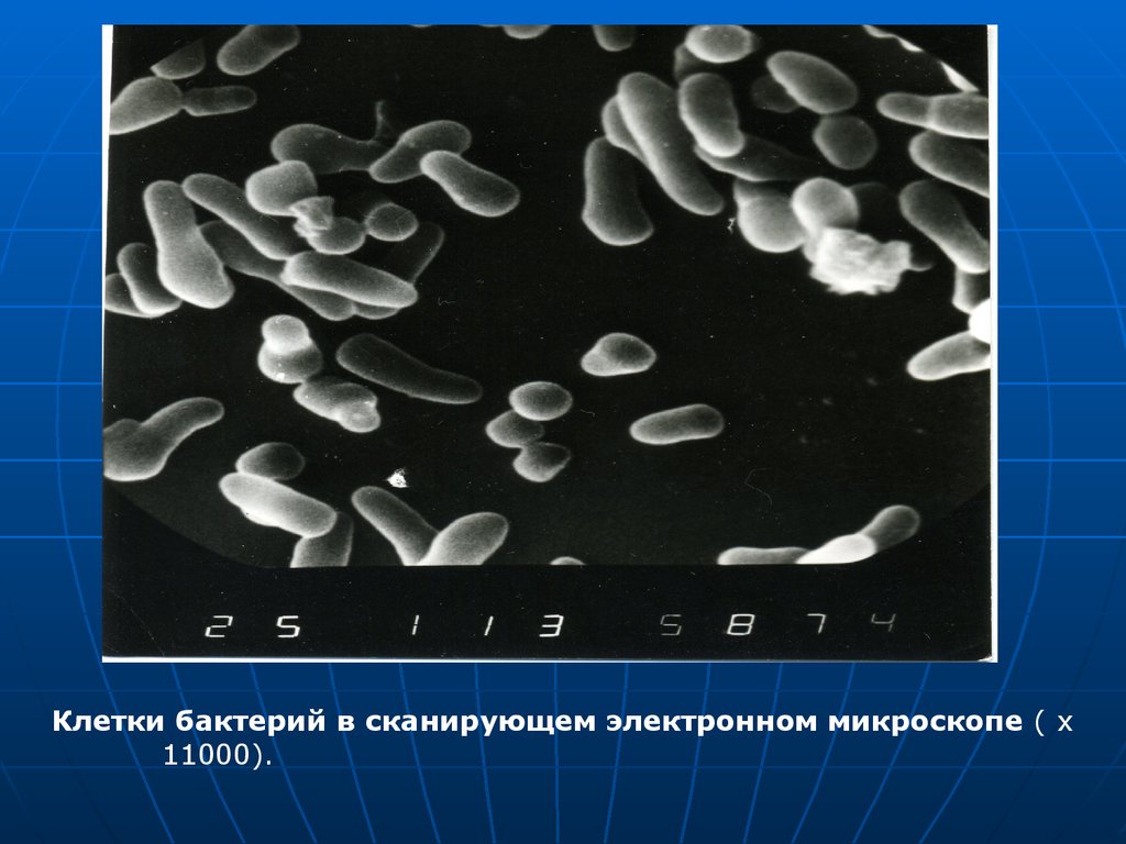 Большинство бактерий можно увидеть. Клетка бактерии в микроскопе. Бактериальная клетка в микроскопе. Бактерии электронная микроскопия. Бактерии в электронном микроскопе.