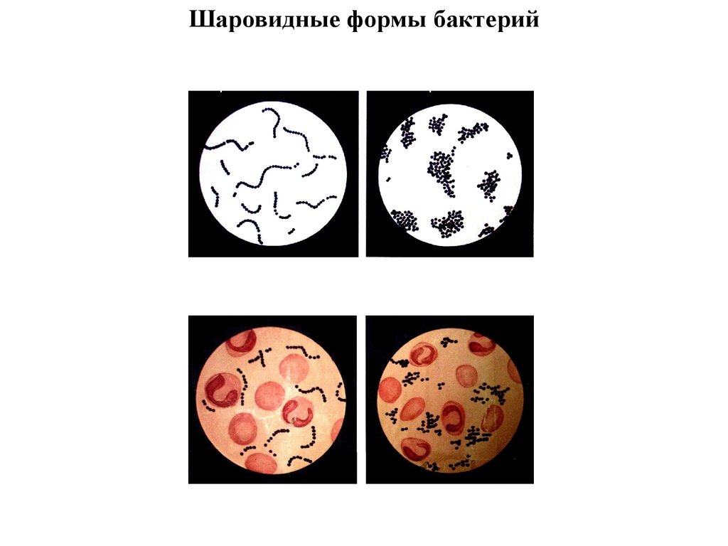 Бактерии округлой формы