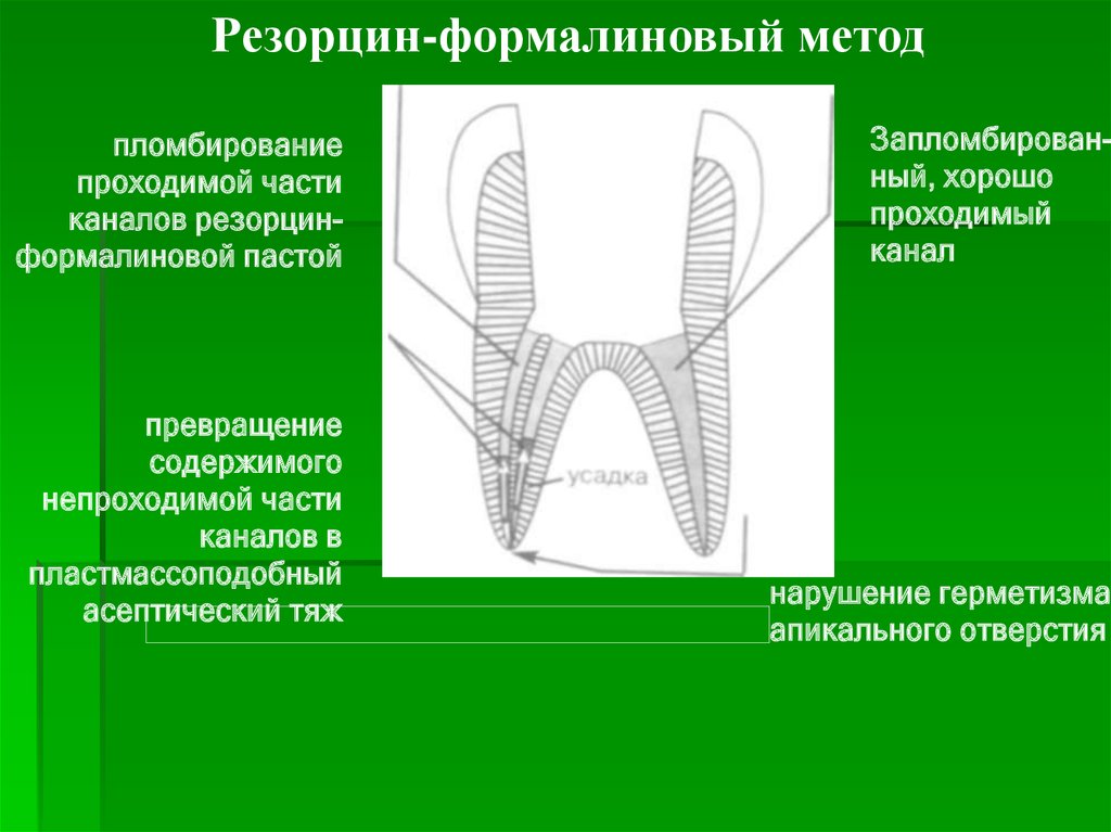 Методы лечения зубов с проблемными корневыми каналами презентация