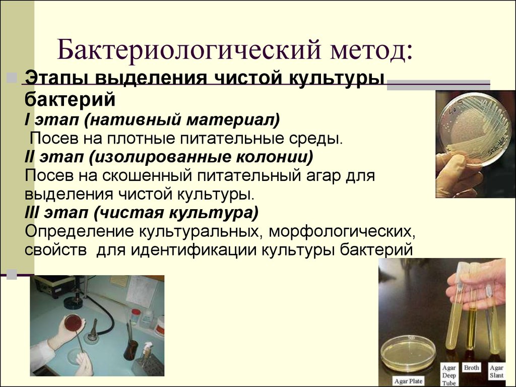 2 этап бактериологического метода