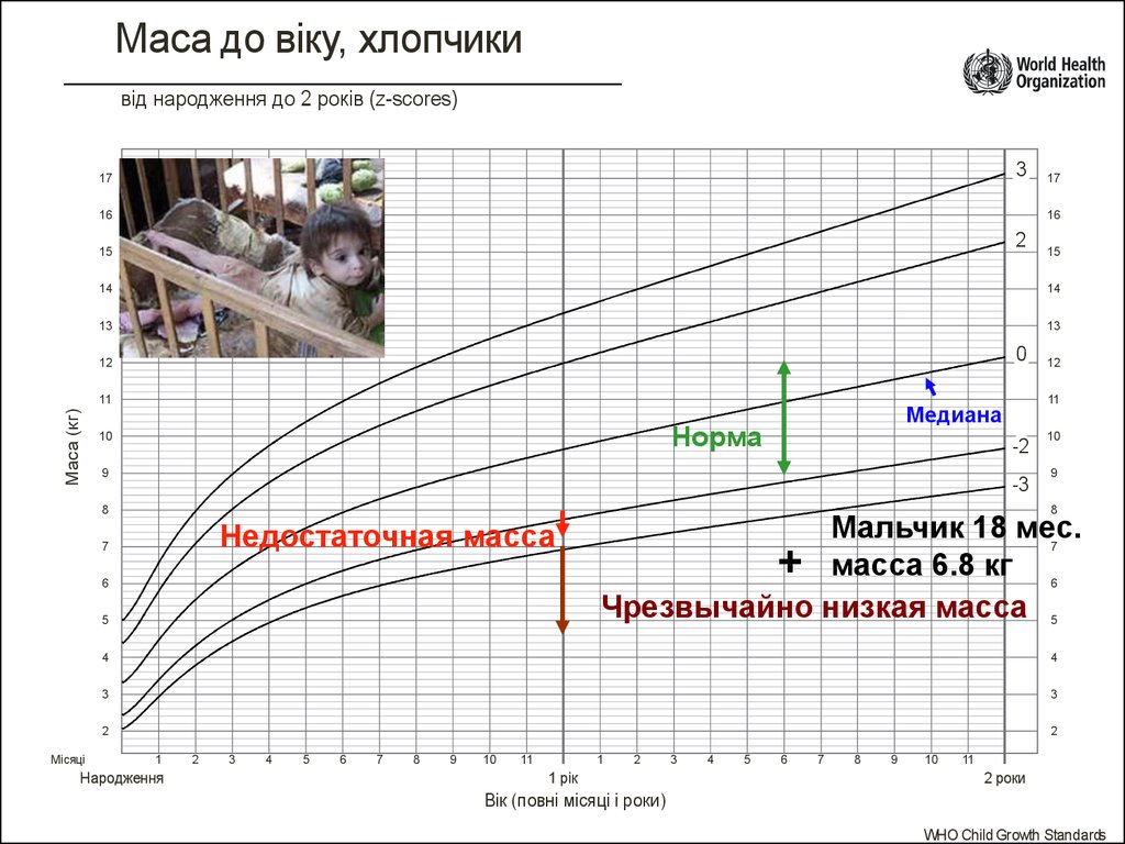 Низкая масса. Медиана веса в кг. Медиана веса в кг как считать.