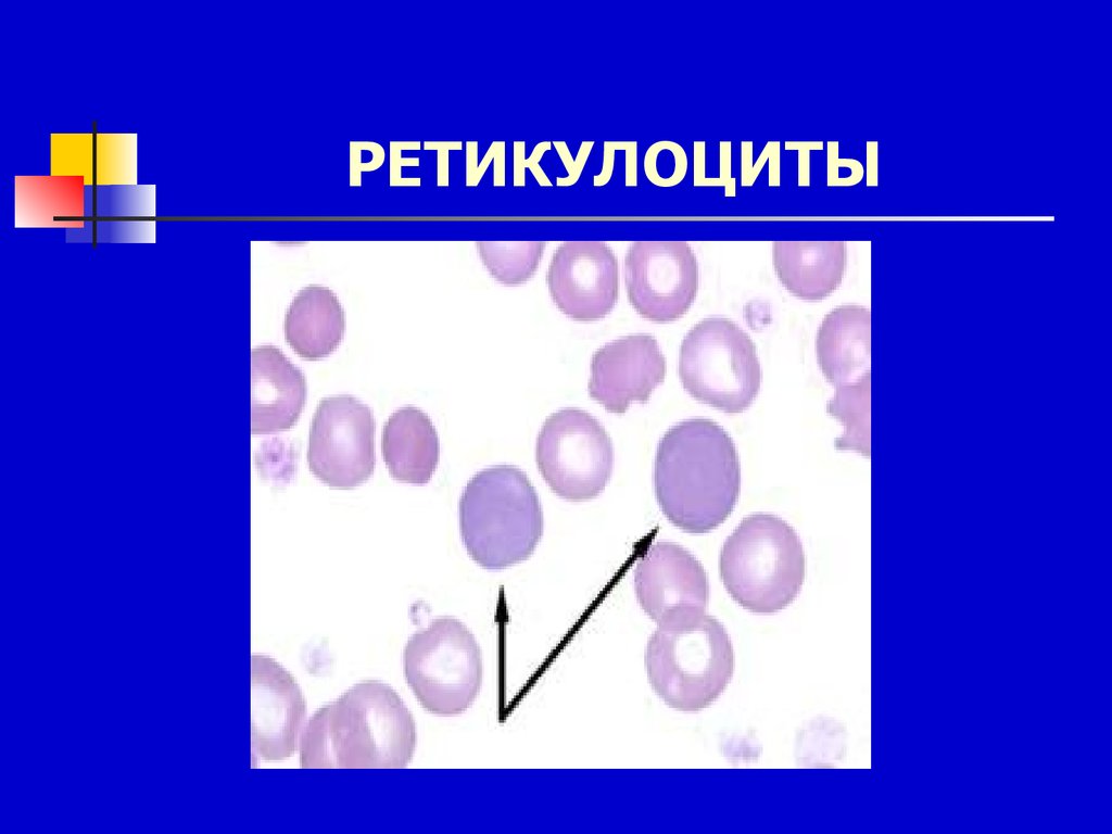 Ретикулоциты это. Ретикулоциты функции. Ретикулоциты в крови. Ретикулоциты морфология. Ретикулоциты методы окраски.